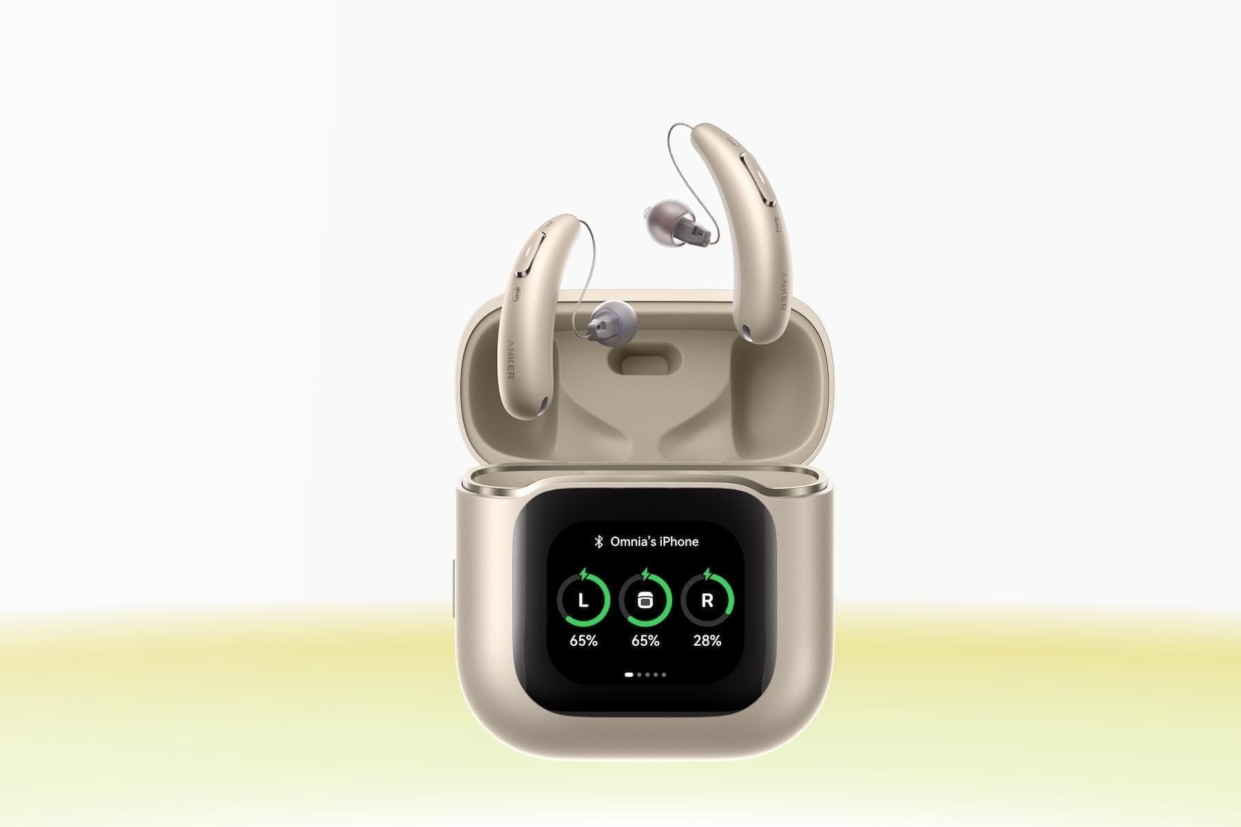 Anker Drops a 7.2-Billion-Op AI Chip Into Hearing Aids — Weeks After a $100M Pioneer Collapsed